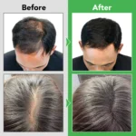 Aliver Rosemary Strengthening Shampoo- 300ml - Image 10