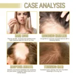 EELHOE Multioil Formula for Hair Growth - 60ml - Image 6