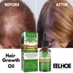 EELHOE Rosemary Essential Oil - 30ml - Image 6