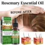 EELHOE Rosemary Essential Oil - 30ml - Image 4